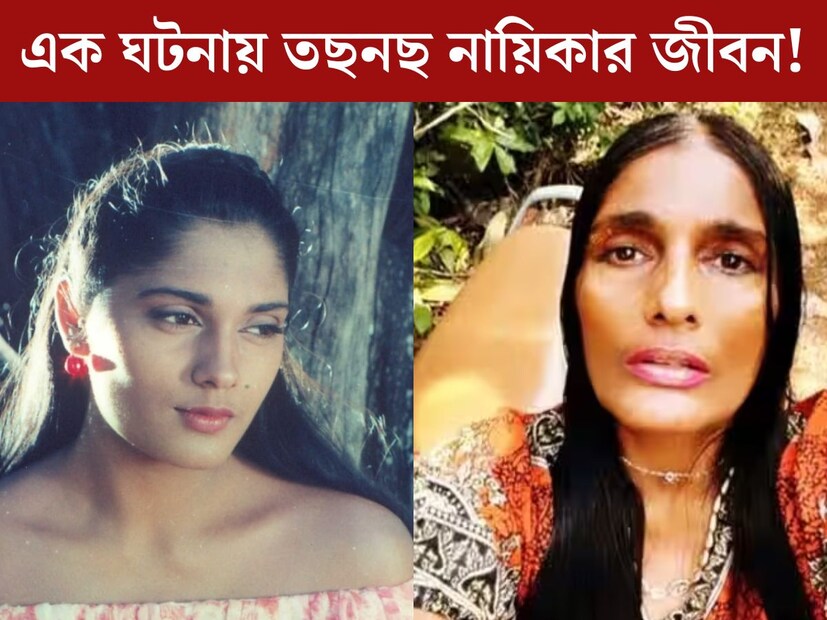 এক ছবি দিয়েই গোটা দেশ চিনেছিল তাঁকে। ‘আশিকি’ ছবি মুক্তির পরেই গ্ল‍্যামার দুনিয়ায় রাতারাতী জনপ্রিয়তা পান অনু আগরওয়াল। ৯০-এর দশকের এই ছবি ছিল সুপারহিট। কিন্তু সেই তুমুল জনপ্রিয় নায়িকার জীবনে তছনছ করে দেয় একটি অ‍্যাকসিডেন্ট।
