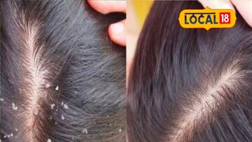 প্রতীকী