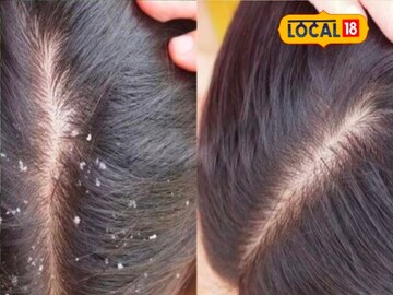 প্রতীকী