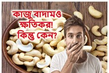 বিরাট ক্ষতি করে দেয় কাজু! ‘এই’ রোগীরা ভুলেও ছোঁবেন না! চুপিসারেই বাড়িয়ে দেবে