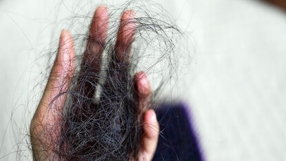 দলা দলা চুল উঠে যাচ্ছে? দলা দলা চুল উঠে যাচ্ছে?