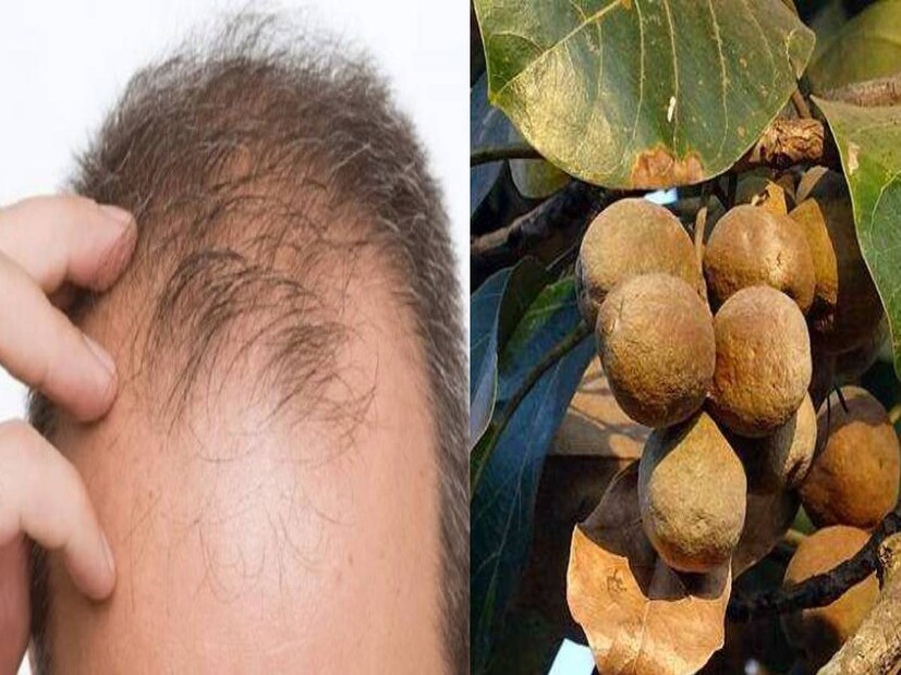 আয়ুর্বেদিক ডাক্তার, ডাঃ দীপ্তি নামদেব জানান, চুলের জন্য এই বহেড়া অত্যন্ত ভাল ওষুধ৷ এমনকি, হরমোন জনিত সমস্যার জন্য যাঁদের চুল ঝরে যায়, তাঁরাও এই বীজের গুড়ো জলে গুলে পেস্ট করে চুলের গোড়ায় লাগাতে পারেন। এতে উপকার পাওয়া যায়৷ 