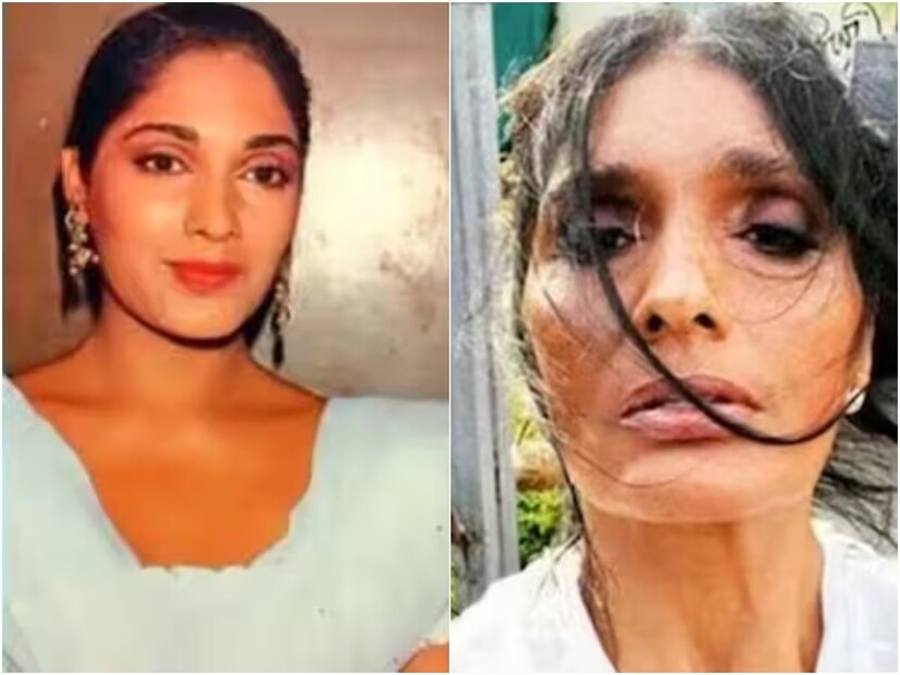 এতটাই জখম হয়েছিলেন নায়িকা, যে কিছুদিনের জন্য কোমায় চলে যান৷ টানা ২৯ দিন আইসিইউ-তে থাকার পর জ্ঞান ফেরে নায়িকার। দুর্ঘটনার পর বহু স্মৃতি মন থেকে মুছে গিয়েছিল তাঁর। 