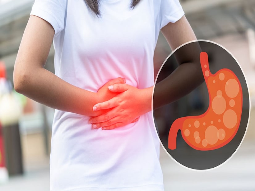 সবুজ শাক-সব্জি বেশি খেলে অ্যাসিডিটির সমস্যা অনেক কম হবে। সজনে ডাঁটা, বিনস, কুমড়ো, বাঁধাকপি, গাজর, পেঁয়াজকলি জাতীয় সবজি খেলে সমস্যা অনেক কমে যাবে। (Disclaimer: এই প্রতিবেদনটি কেবলমাত্র সাধারণ তথ্যের জন্য, তাই বিস্তারিত জানতে হলে সর্বদা বিশেষজ্ঞের পরামর্শ নিন।)