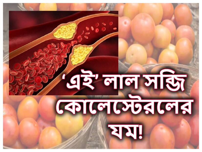 রক্তে উচ্চ মাত্রায় কোলেস্টরেল থাকা এখন প্রতিটা ঘরের সমস্যা৷ রক্তে কোলেস্টেরলের মাত্রা বাড়লে বাড়ে হার্ট অ্যাটাকের ঝুঁকিও বাড়ে৷ যাঁরা কোলেস্টেরলের সমস্যায় ভোগেন তাঁদের প্রতিনিয়ত ওষুধ খেয়ে যেতে হয়৷ 