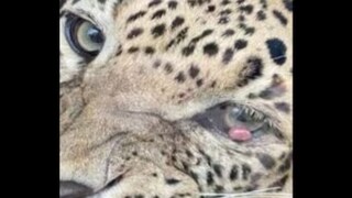  'রক্তচক্ষু' চিকিৎসায় বড় সাফল্য 'বনতারা'-য়