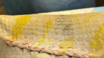 বার্মিজ পাইথনের সফল অপারেশন 'বনতারা'-য়, চলছে অস্ত্রোপচার পরবর্তী যত্নআত্তি বার্মিজ পাইথনের সফল অপারেশন 'বনতারা'-য়, চলছে অস্ত্রোপচার পরবর্তী যত্নআত্তি