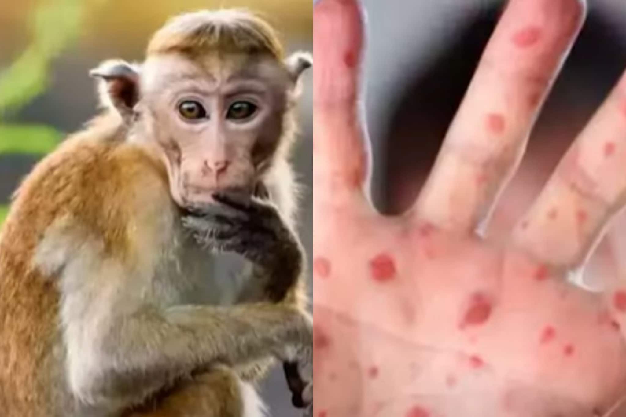 Monkey Fever: কোভিডের পর নয়া বিপদ! এবার আতঙ্কের নাম 'মাঙ্কি ফিভার'