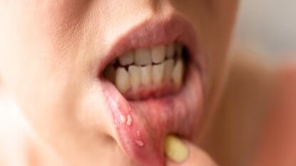 প্রতীকী ছবি প্রতীকী ছবি