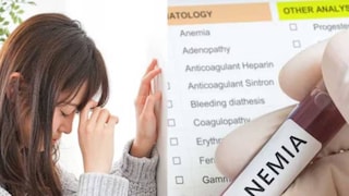 অ্যানিমিয়ায় ভুগছেন? রোজ পাতে রাখুন এই খাবার, পাবেন ভরপুর আয়রন, হিমোগ্লোবিনের মাত্রা বাড়বে হু হু করে
অ্যানিমিয়ায় ভুগছেন? রোজ পাতে রাখুন এই খাবার, পাবেন ভরপুর আয়রন, হিমোগ্লোবিনের মাত্রা বাড়বে হু হু করে