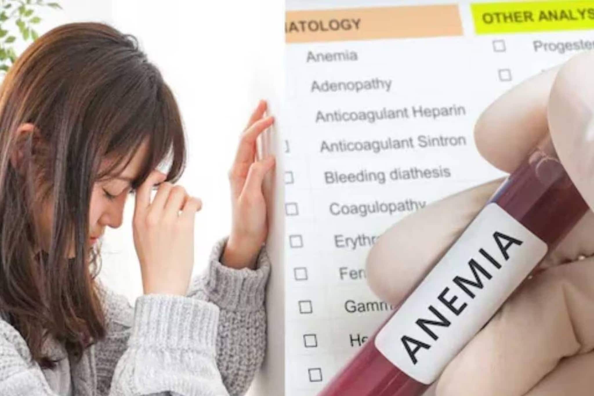 অ্যানিমিয়ায় ভুগছেন? রোজ খান এই খাবার, হিমোগ্লোবিনের মাত্রা বাড়বে হু হু করে