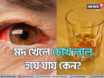 বলুন তো মদ খেলে চোখ 'লাল' হয়ে যায় কেন...? আসল 'কারণ' কিন্তু জানেন না অনেকেই বলুন তো মদ খেলে চোখ 'লাল' হয়ে যায় কেন...? আসল 'কারণ' কিন্তু জানেন না অনেকেই