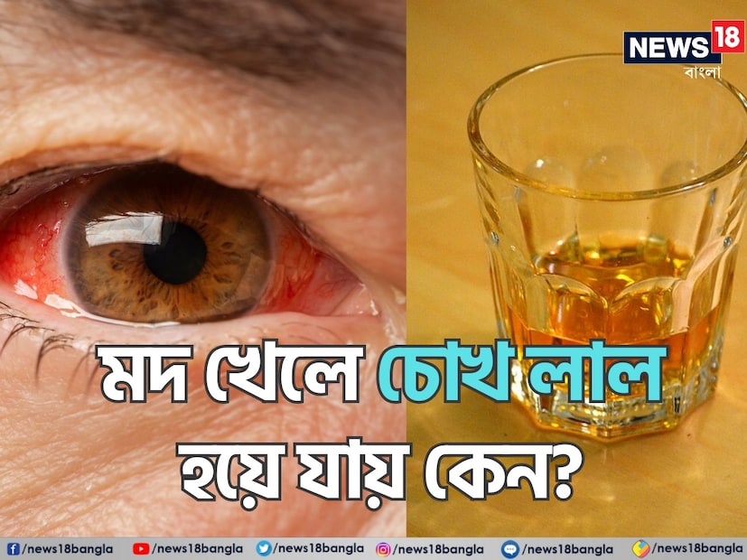 মদ্যপান স্বাস্থ্যের পক্ষে ক্ষতিকর। তবে জানা সত্বেও অনেকেই নিয়মিত মদ্যপান করেন। কম বা বেশি বয়সী, নারী হোন বা পুরুষ, অনেকেই আছেন যাঁরা এই ধরনের অ্যালকোহলিক পানীয়গুলি খেতে পছন্দ করেন। তবে এই ধরণের পানীয় শরীরে নানা প্রভাব ফেলে। যার কিছুটা বাহ্যিক, কিছুটা ভিতরের। মদ্যপান স্বাস্থ্যের পক্ষে ক্ষতিকর। তবে জানা সত্বেও অনেকেই নিয়মিত মদ্যপান করেন। কম বা বেশি বয়সী, নারী হোন বা পুরুষ, অনেকেই আছেন যাঁরা এই ধরনের অ্যালকোহলিক পানীয়গুলি খেতে পছন্দ করেন। তবে এই ধরণের পানীয় শরীরে নানা প্রভাব ফেলে। যার কিছুটা বাহ্যিক, কিছুটা ভিতরের।