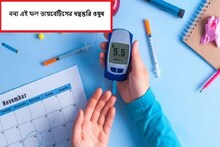 বন্য এই ফল দেখতে তেঁতুলের মতো,ডায়াবেটিস রোগীদের জন্য ধন্বন্তরি,হজমশক্তিও বাড়বে