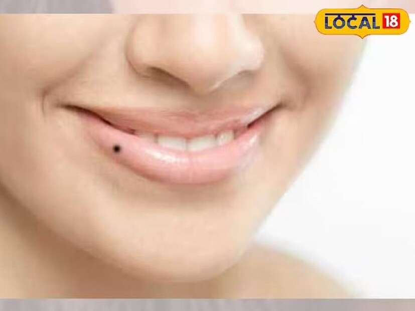 আবার মানুষের কপালে তিল থাকাকে ধনী হওয়ার লক্ষণ হিসেবে ধরে নেওয়া হয়। এমন ব্যক্তির সম্পদ ক্রমবর্ধমান। আর অর্থের অভাব তো হয় না বললেই চলে।