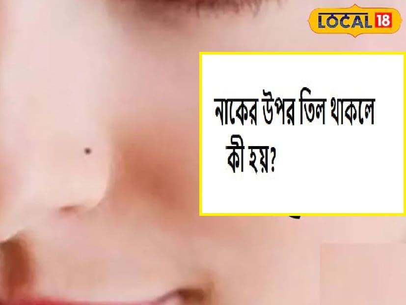 আবার এটাও বলা হয় যে, যাঁদের চিবুকে তিল থাকে, তাঁরা কৌতুকপূর্ণ হন।আবার মনে করা হয়, কারও নাকে তিল থাকলে তিনি জীবনে অনেক ভ্রমণ করবেন। শুধু তা-ই নয়, এই মানুষগুলি সাধারণত নতুন কিছু শিখতে আগ্রহী। এঁদেরও ভাগ্যবান বলে গণ্য করা হয়। সারা জীবনে প্রচুর অর্থ উপার্জনে সক্ষম হন।