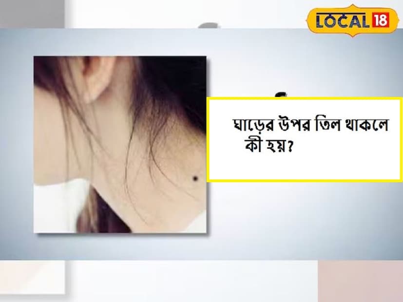 ড. অনীশ জানান, গলার সামনের দিকে তিল থাকলে তিনি ভাগ্যবান হন। আর শৈল্পিক দক্ষতাও থাকে তুঙ্গে।আবার কারও ডান গালে তিল থাকলে তিনি যুক্তিবাদী প্রকৃতির হয়ে থাকেন। এমনকী তিনি অর্থ উপার্জনেও দারুণ সক্ষম হন।