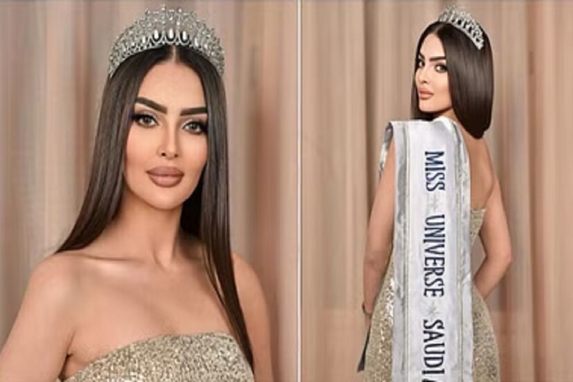 প্রসঙ্গত রুমি আলকাহতানি সৌদি আরবের রাজধানী রিয়াধের বাসিন্দা। যুবরাজ মহম্মদ বিন সলমনের শাসনে চিরাচরিত প্রথা ভেঙে আধুনিকতাকে বরণ করে নিচ্ছে সৌদি আরব। ইতিমধ্যেই বেশ কিছু বিধিনিষেধ শিথিল করা হয়েছে। তবে ঐতিহ্যগতভাবে এখনও কঠোর ধর্মীয় ও সামাজিক নিয়ন্ত্রণ বজায় রেখেছে আরব উপদ্বীপের বৃহত্তম দেশ। গত কয়েক বছরে বেশ কিছু যুগান্তকারী পরিবর্তনের সাক্ষীও হয়েছেন সৌদির মানুষ। মহিলাদের গাড়ি চালানোয় অনুমতি দেওয়া হয়েছে। পুরুষ অভিভাবক ছাড়া পাসপোর্টের জন্যও এখন আবেদন করতে পারেন তাঁরা। Photo Courtesy: Rumy Alqahtani/Instagram