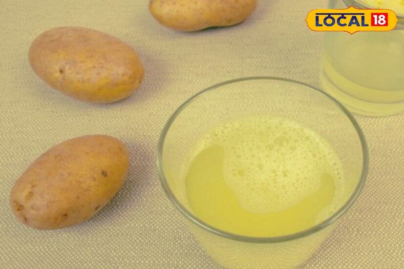 কিছু ঘরোয়া উপায় রয়েছে যা মুখের দাগ কমাতে পারে সহজেই। মুখের এই সকল দাগের উপর আলুর রস লাগাতে পারেন। আলুর রসের ব্লিচিং বৈশিষ্ট্য দাগ হ্রাস করবে এবং জ্বেল্লা বৃদ্ধি পাবে সহজেই।