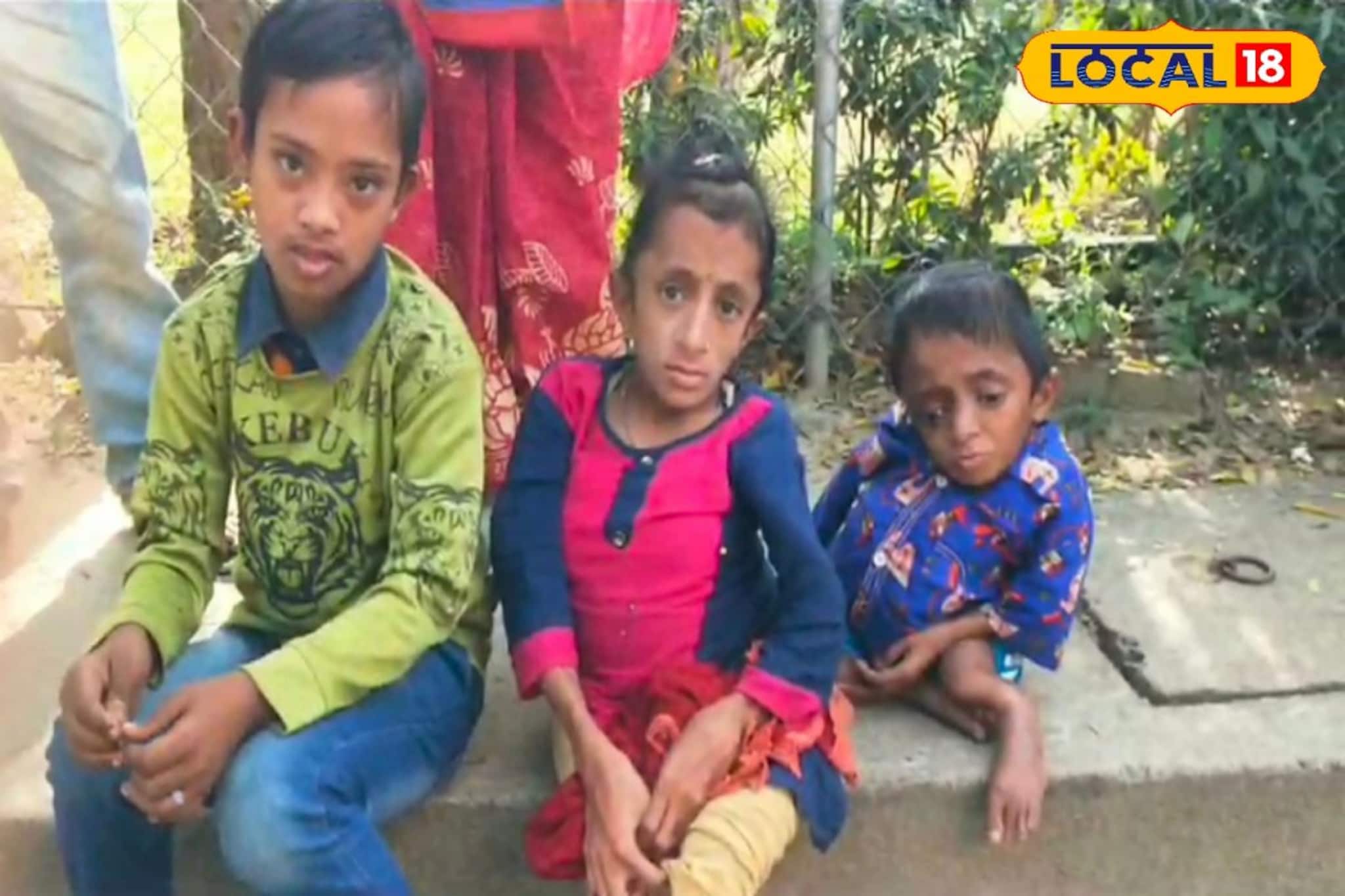 মিলছে না আঙুলের ছাপ, চরম সমস্যায় একই পরিবারের তিন বিশেষভাবে সক্ষম