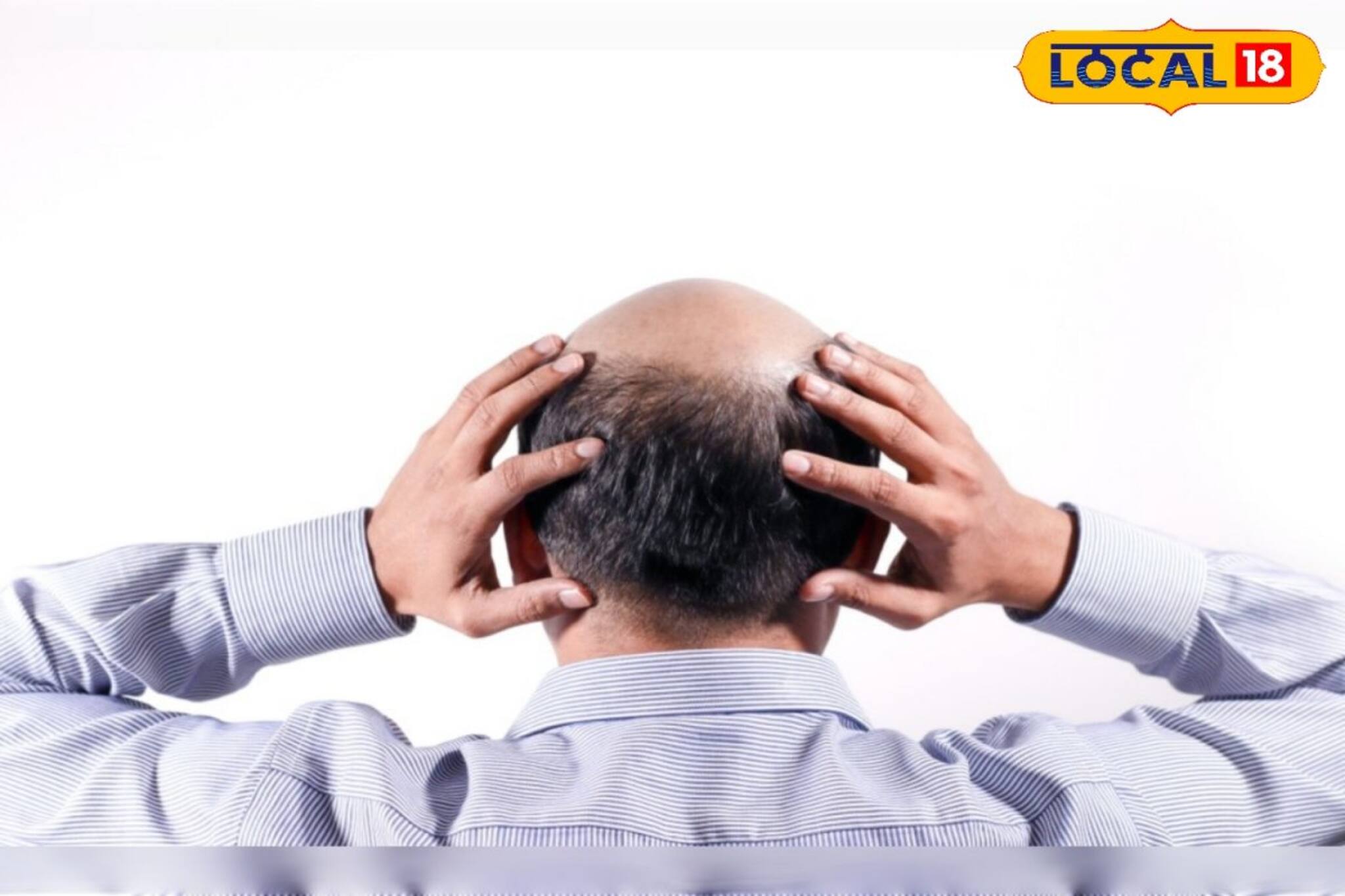 মাথায় টাক হয়ে যাচ্ছে, অকালেই উধাও সৌন্দর্য্য! ‘এই’ কাজ করলেই গজাবে চুল