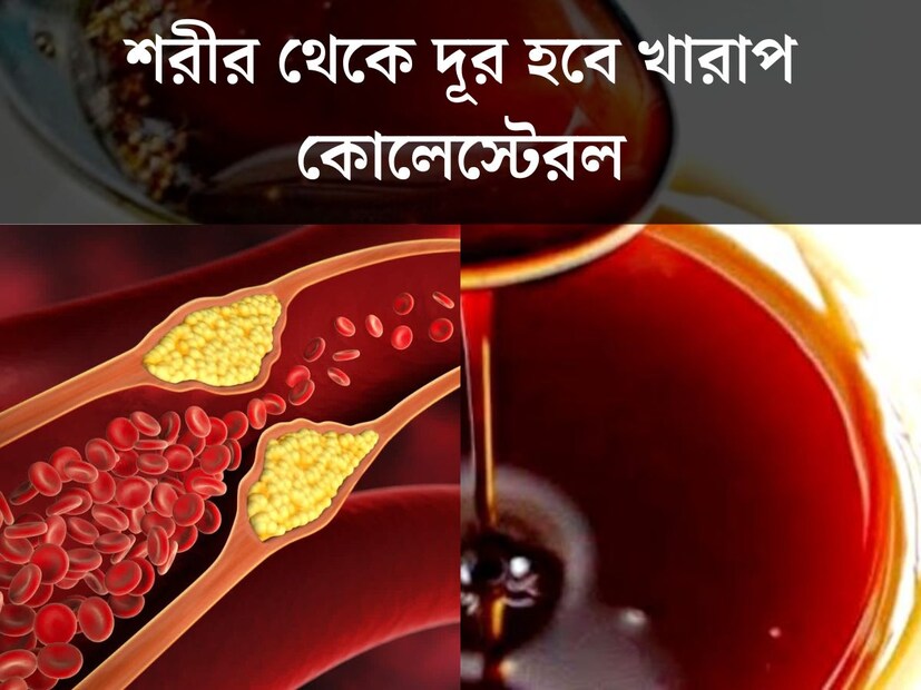 ডায়াবেটিস, কোলেস্টেরল, ব্লাড প্রেশার। এই শব্দগুলি বর্তমানে সকলের চেনা। প্রচুর মানুষ এই রোগগুলিতে আক্রান্ত। রোগের দাপটেই রোজের সঙ্গী হয়েছে গাদা গাদা ওষুধ। আয়ুর্বেদাচার্য জানালেন, ঘরোয়া খাবারেই জিনিসেই দূরে থাকবে কোলেস্টেরল।