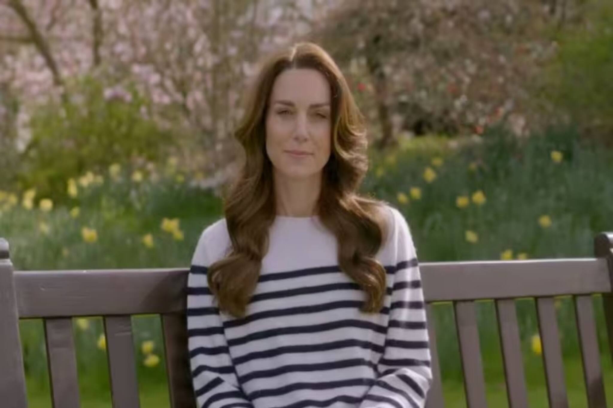 ক্যানসারে আক্রান্ত যুবরানি কেট! চলছে প্রিভেনটেটিভ কেমোথেরাপি, এটি কী?