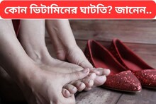 কেন হাতে পায়ে ঝিন ধরে জানেন?...কোন ভিটামিনের অভাবে? খবরদার ফেলে রাখবেন না একদম!