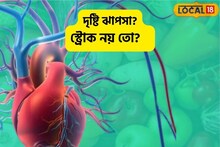 হঠাৎ চোখের দৃষ্টি ঝাপসা? স্ট্রোক নয় তো? বুঝতে গেলে জানতে হবে ৩টি নিয়ম