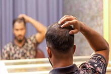 টাক পড়ে একাকার? চুল দিয়ে টাক ঢাকতে হয়? এই সমস্যার সমাধান হবে নিমেষেই, জানুন