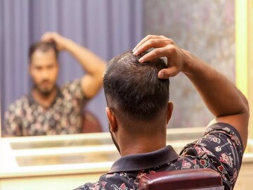 টাক পড়ে একাকার? চুল দিয়ে টাক ঢাকতে হয়? এই সমস্যার সমাধান হবে নিমেষেই, জানুন
