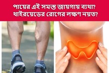 পায়ের এই সমস্ত অংশে চরম ব্যথা? শরীরে চুপিসারে বাড়ছে না তো থাইরয়েড! আগে দেখুন
