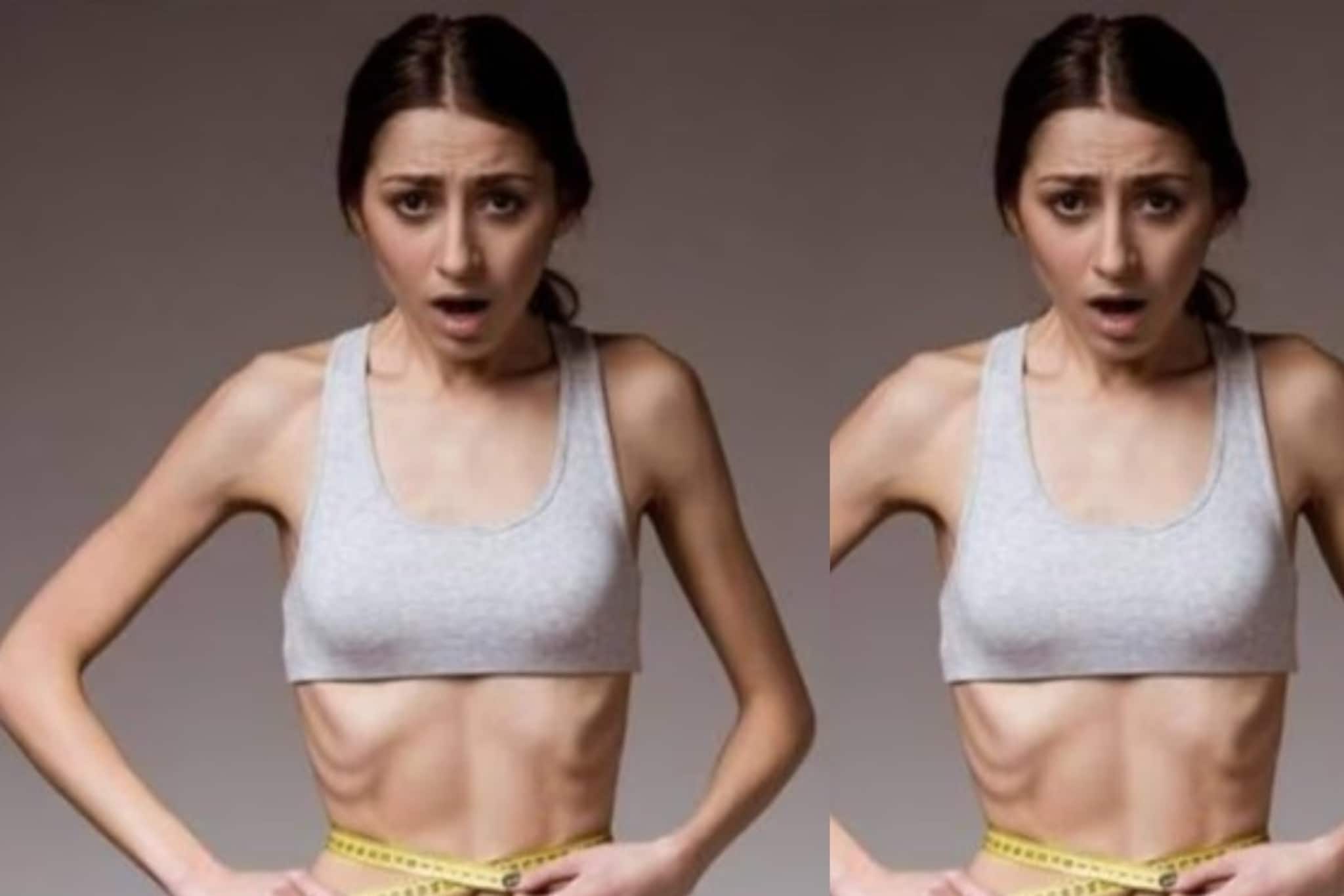 ভয়ানক বিকট চেহারা...! হাড় বেরিয়ে আসছে? কীভাবে বাড়াবেন ওজন? রইল ম্যাজিক টিপস