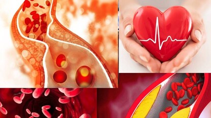 সাধ্যের মধ্যে খরচে দ্রুত কোলেস্টেরল নিয়ন্ত্রণ করে টম্যাটোর রস সাধ্যের মধ্যে খরচে দ্রুত কোলেস্টেরল নিয়ন্ত্রণ করে টম্যাটোর রস