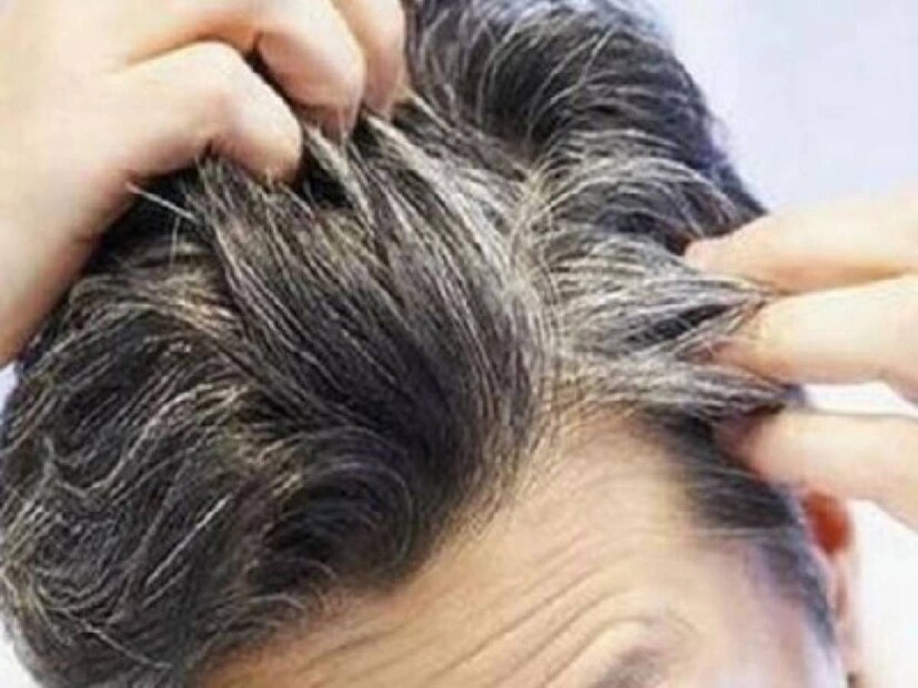 সাদা চুল হয়ে যায় কালো: কালো তিল চিনে হেই জি মা নামে পরিচিত। চিনারা বিশ্বাস করেন, এই তিল সাদা চুলকে কালো করে দিতে পারে। গুড়কে চিনে কিউই বলা হয়। এটি রক্ত ​​সঞ্চালন বৃদ্ধি বলে মনে করা হয়। সাধারণ বিশ্বাস, এটি চুলকে সুস্থ রাখে বলে৷