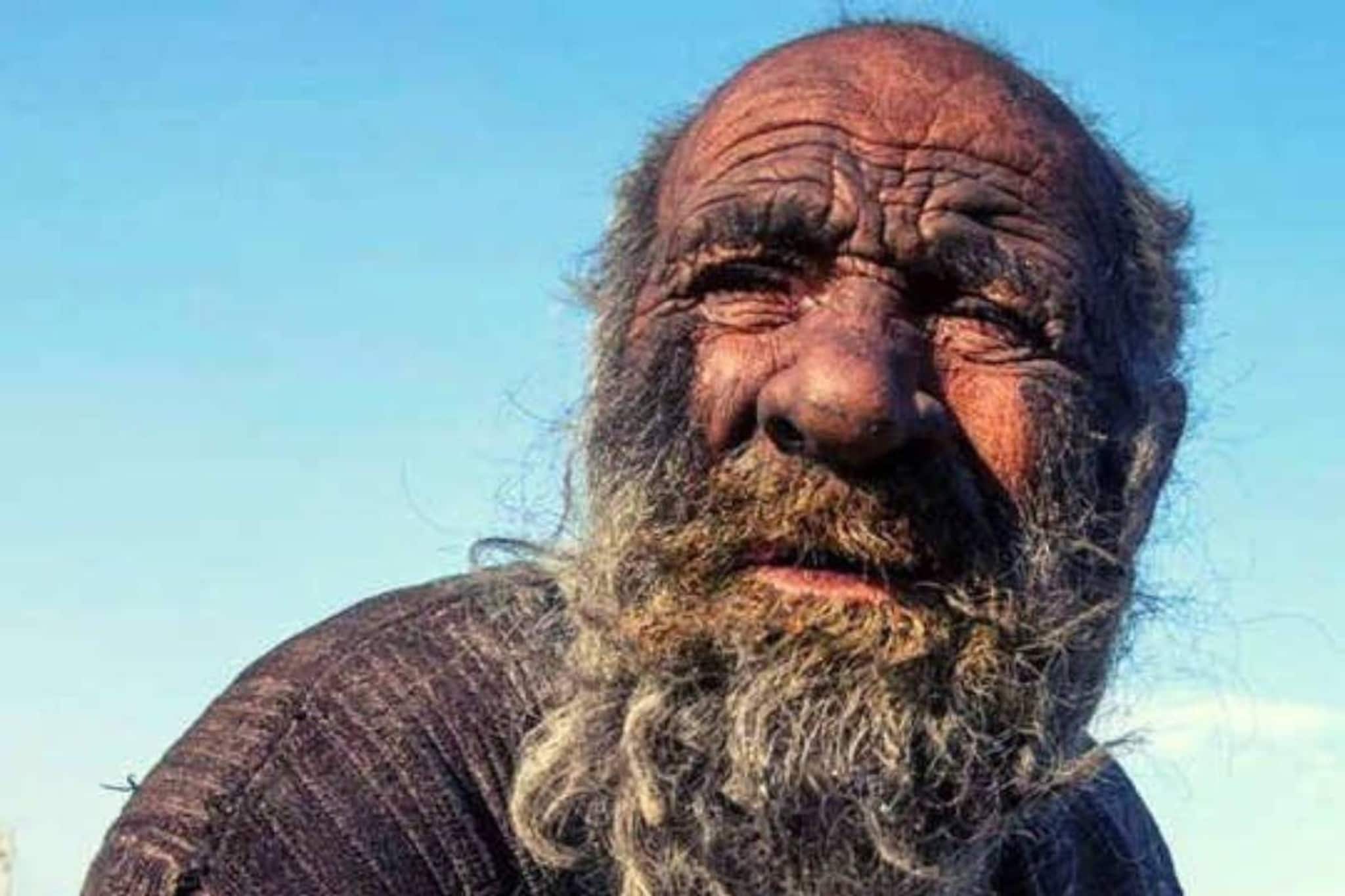 প্রিয় খাবার মৃত পশু! বলুন তো বিশ্বের সবচেয়ে 'নোংরা' ব্যক্তিটি কে, শিউরে মতো গল্প