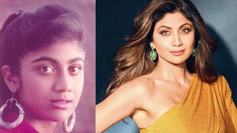 বাজিগরের শিল্পা আর এখনকার শিল্পাকে দেখলে চিনবে কার সাধ্য। দেশিল্পা নিজেই খোলামেলাভাবে জানিয়েছেন তাঁর নাকে দুটি সার্জারি তিনি করিয়েছিলেন। বর্তমানে বড় পর্দায় তাঁকে খুব একটা দেখা যায় না।