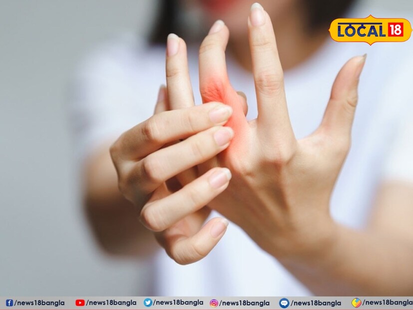 অনেকেই আছেন গ্যাস, অম্বলের সমস্যায় ভোগেন। কাঁচা হলুদের সঙ্গে গুড় মিশিয়ে খেলে এই সমস্যার উপকার পাওয়া যায়। গুড় পেটকে ঠাণ্ডা রাখে। আর সঙ্গে কাঁচা হলুদ যোগ হলে তো কোন কথাই নেই। তাই এই সমস্যায় রোজ কাঁচা হলুদের সঙ্গে গুড় খাওয়া উচিৎ।তথ্য -সুস্মিতা গোস্বামী