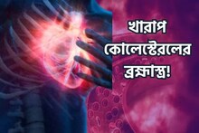 গ্যারান্টি...! কোলেস্টেরল জব্দ হবে মাত্র ৭ দিনে! ঘুম থেকে উঠেই করুন 'এই' কাজ