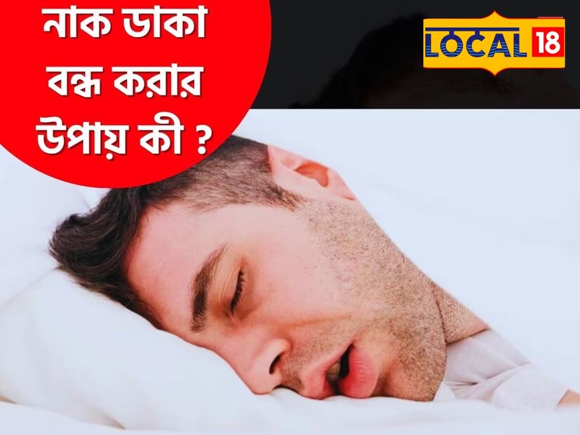 *সারাদিন বিভিন্ন কাজ করার পর বাড়িতে একটু শান্তিতে ঘুমোনোর সময় যদি পাশের জন নাক ডাকার অসহ্য যন্ত্রণায় রাতে ঘুমোতে পারছেন না। আর এই নাক ডাকার জন্য রাতে ঘুমানোর সময় অশান্তি লেগে যাচ্ছে। প্রতিবেদনঃ সুমন সাহা। সংগৃহীত ছবি। 