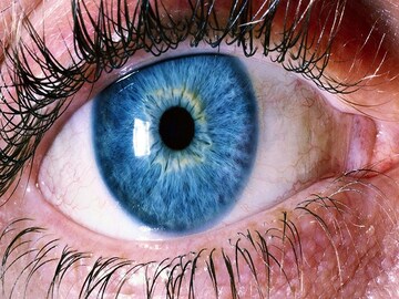 কোন 'ভিটামিনের' অভাবে চোখ খারাপ হয় জানেন...? Eyesight বাঁচাতে 'এইগুলি' খান!