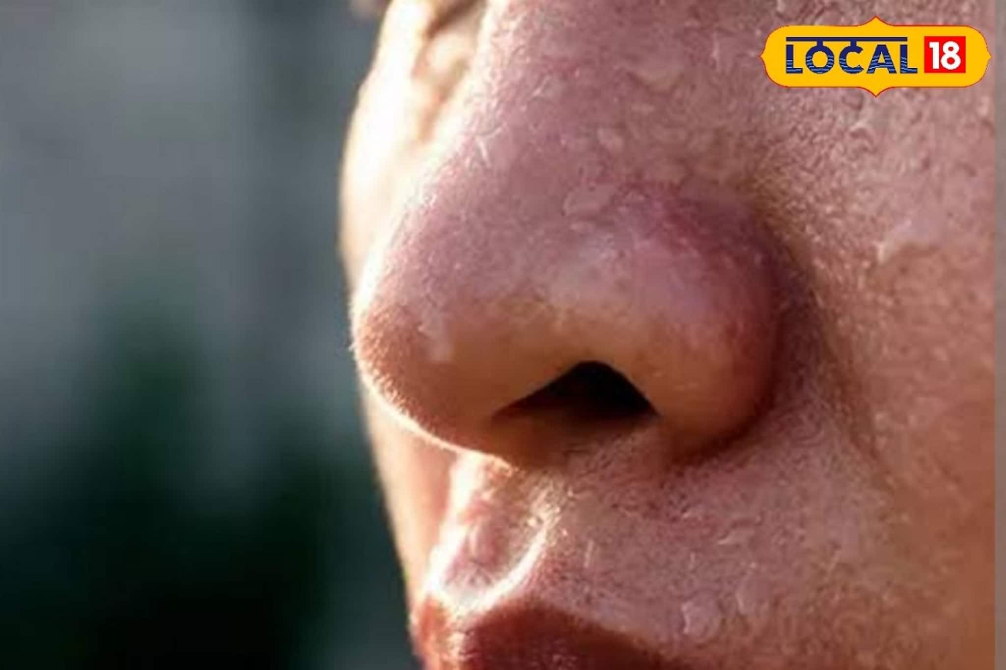 গরম পড়লেই মুখ ঘামতে শুরু করে? মেক-আপ গলে জল! সহজ উপায়ে দূর হবে ঘামের সমস্যা!