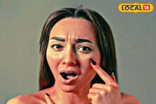 সারা মুখে ট‍্যান? ভরসা রাখুন এই ‘ঘরোয়া’ জিনিসে! ভোল পাল্টে ত্বক হবে উজ্জ্বল!