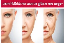 কোন ভিটামিনের অভাবে মানুষ বুড়িয়ে যায় জানেন?...সতর্ক হোন আগে থেকেই! নাহলে...