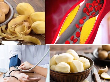 আমরা অনেকেই জানি না আলুর খোসারও প্রচুর গুণ