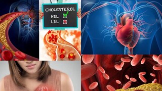 হৃদযন্ত্রের সুস্থতা অনেকাংশে নির্ভর করে দেহের কোলেস্টেরলের মাত্রার উপর