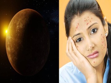 জানেন কুষ্ঠিতে কোন গ্রহ দুর্বল থাকলে মানুষকে খারাপ দেখতে হয়?..আছে কোনও প্রতিকার? জানেন কুষ্ঠিতে কোন গ্রহ দুর্বল থাকলে মানুষকে খারাপ দেখতে হয়?..আছে কোনও প্রতিকার?