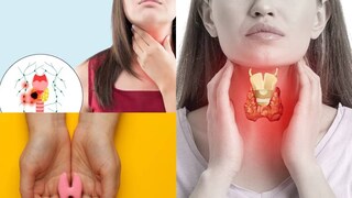 থাইরয়েড সমস্যার শিকার এখন আধুনিক জীবনযাপনের অন্যতম বড় সমস্যা