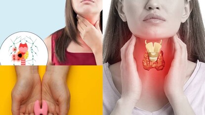 থাইরয়েড সমস্যার শিকার এখন আধুনিক জীবনযাপনের অন্যতম বড় সমস্যা থাইরয়েড সমস্যার শিকার এখন আধুনিক জীবনযাপনের অন্যতম বড় সমস্যা