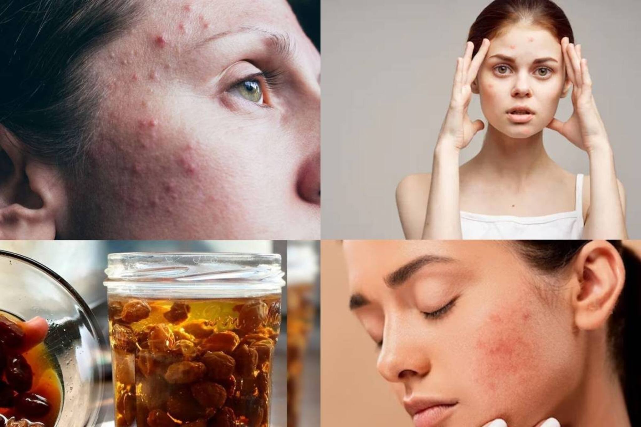 সকালে খালি পেটে খান এই ফল ভেজানো জল, ব্রণ এবং তার ক্ষত মুছে পাবেন মসৃণ ত্বক